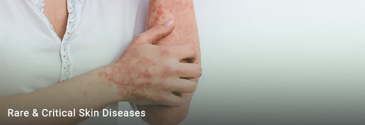 Rare and Severe Dermatologic Disorders