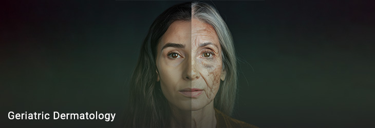 Aging Skin and Geriatric Dermatology