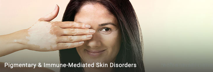 Pigmentary and Immunologic Skin Conditions