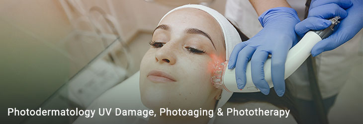 Photodermatology and Light-Based Treatments