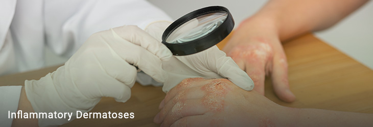 Inflammatory Skin Disorders