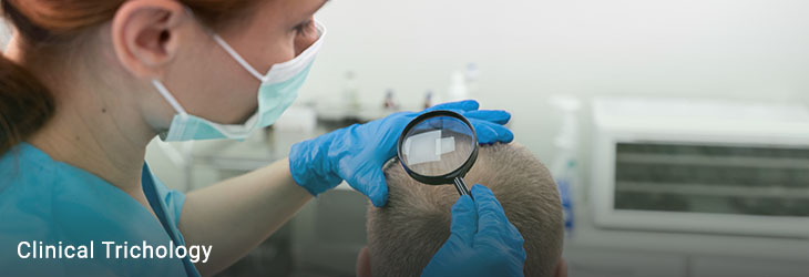 Hair and Scalp Disorders